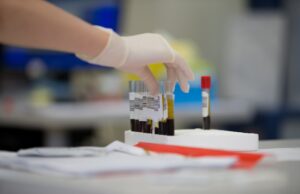 The Definitive Guide to The Micro-Biomarkers Revolution micro-biomarkers specialty blood laboratory invisible inflammation