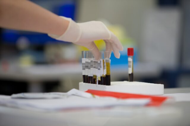 micro-biomarkers specialty blood laboratory invisible inflammation